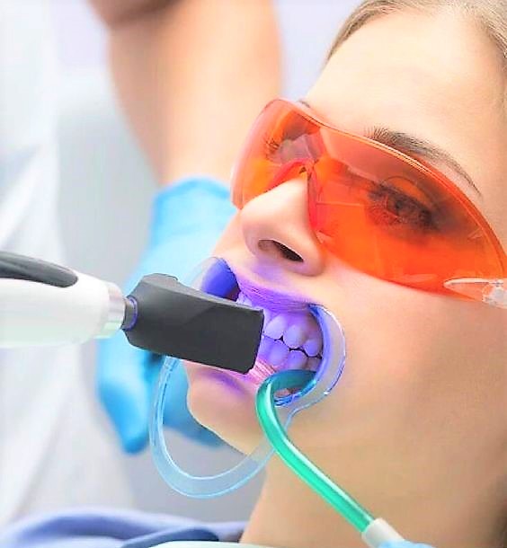 Femeie procesul de Albire dentara cu laser